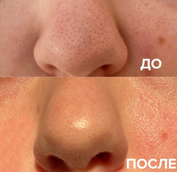 Гайд по чистой коже Blur face (Наталья Bbos)